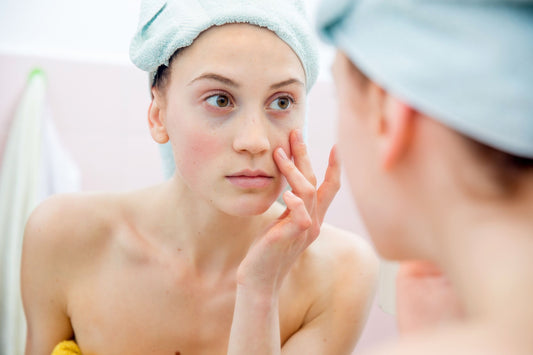 How Healthy pH Can Prevent Having Dry Skin