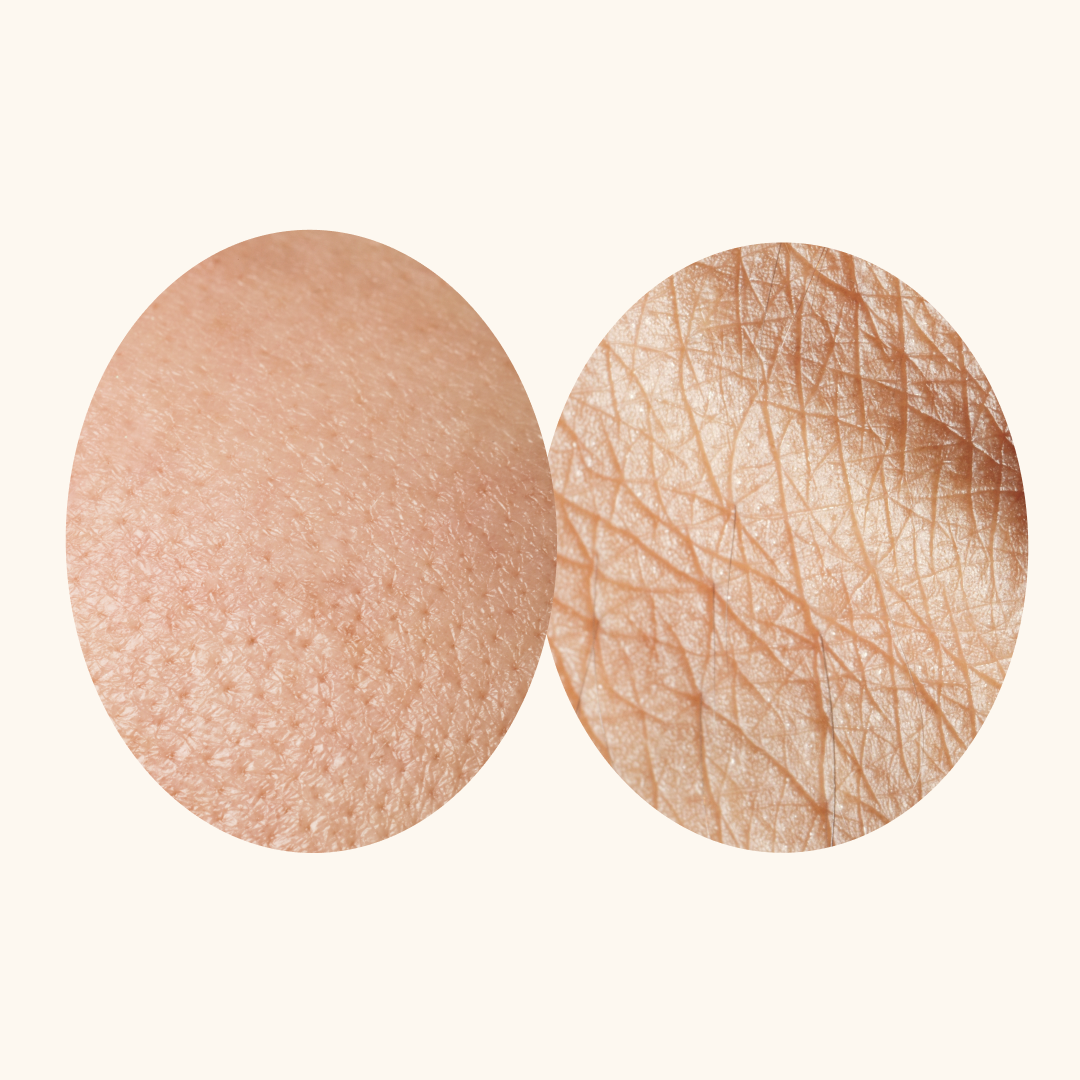 Why Sugar Is Aging Your Skin Faster Than the Sun