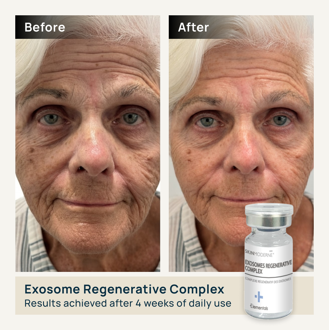 EXOSOMES REGENERATIVE COMPLEX
