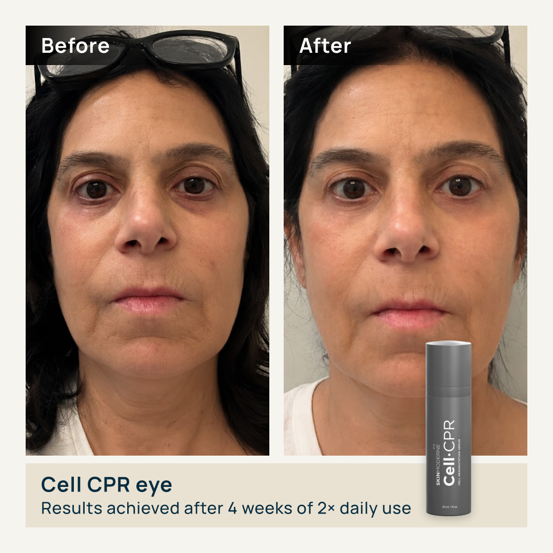 Cell-CPR Eye