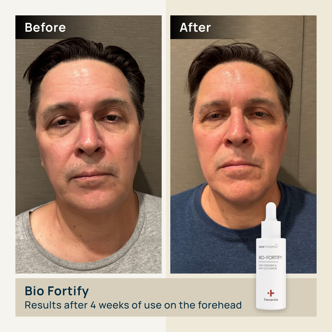 BIO-FORTIFY