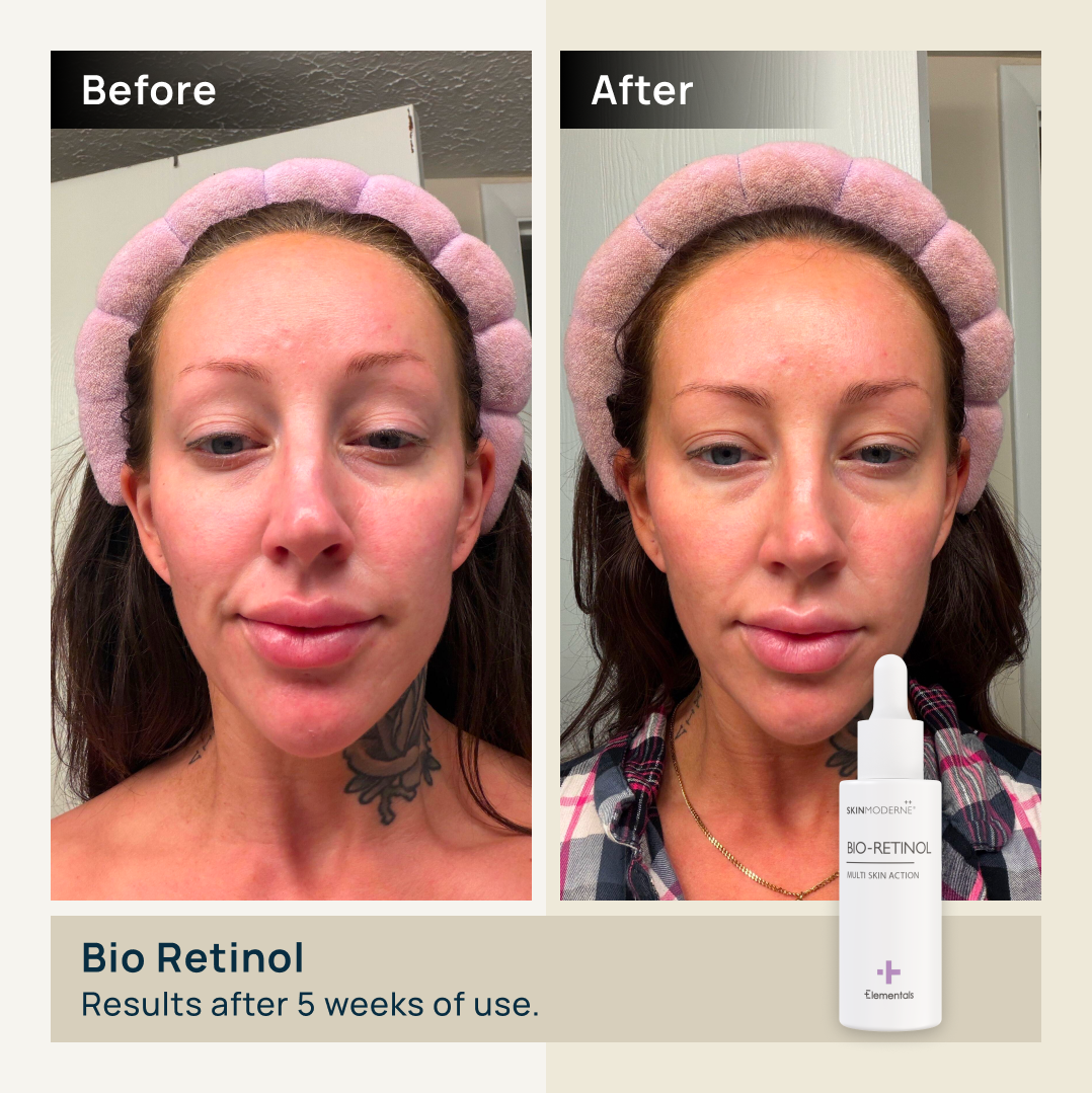 BIO-RETINOL